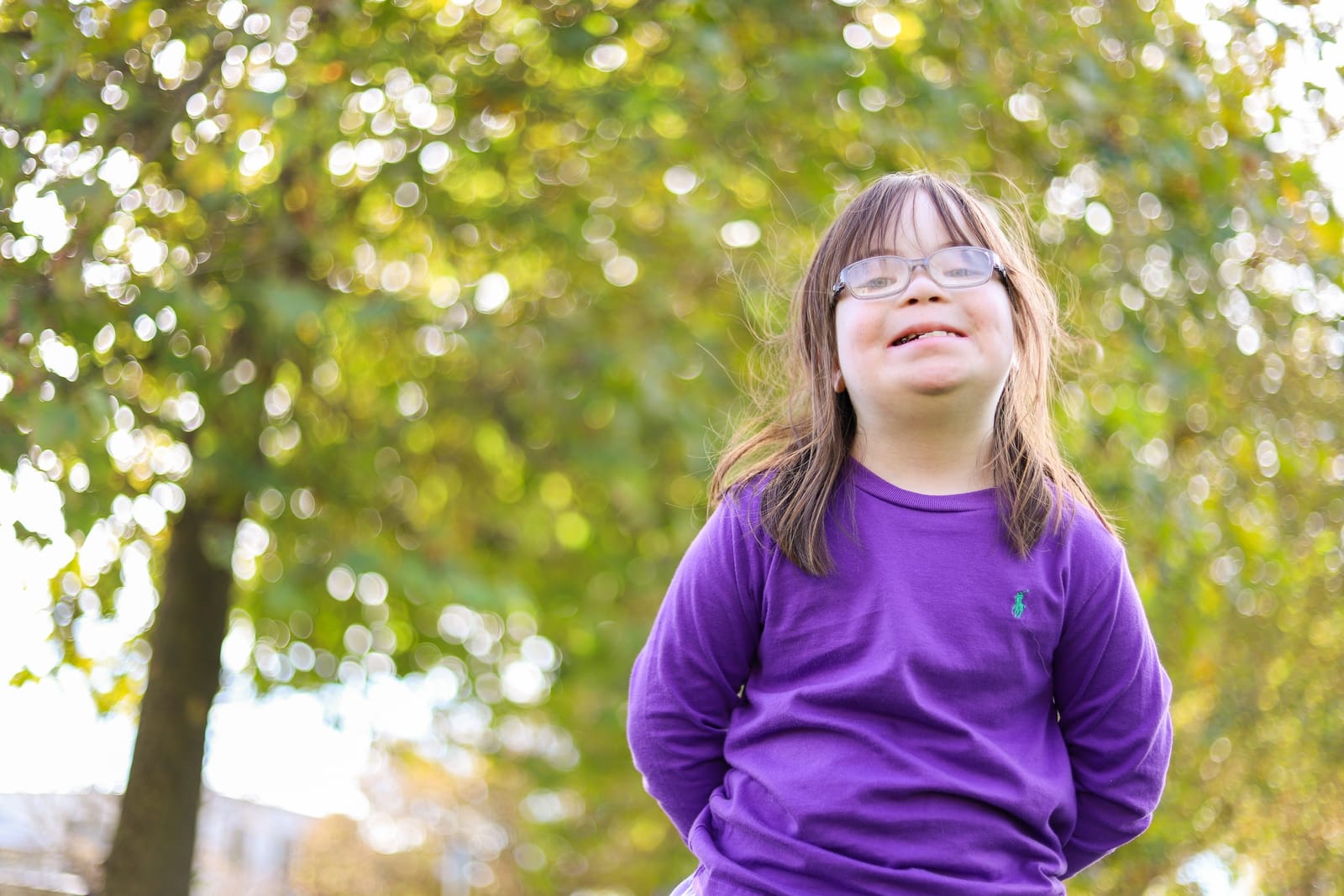 Beautiful smile, girl with Down syndrome